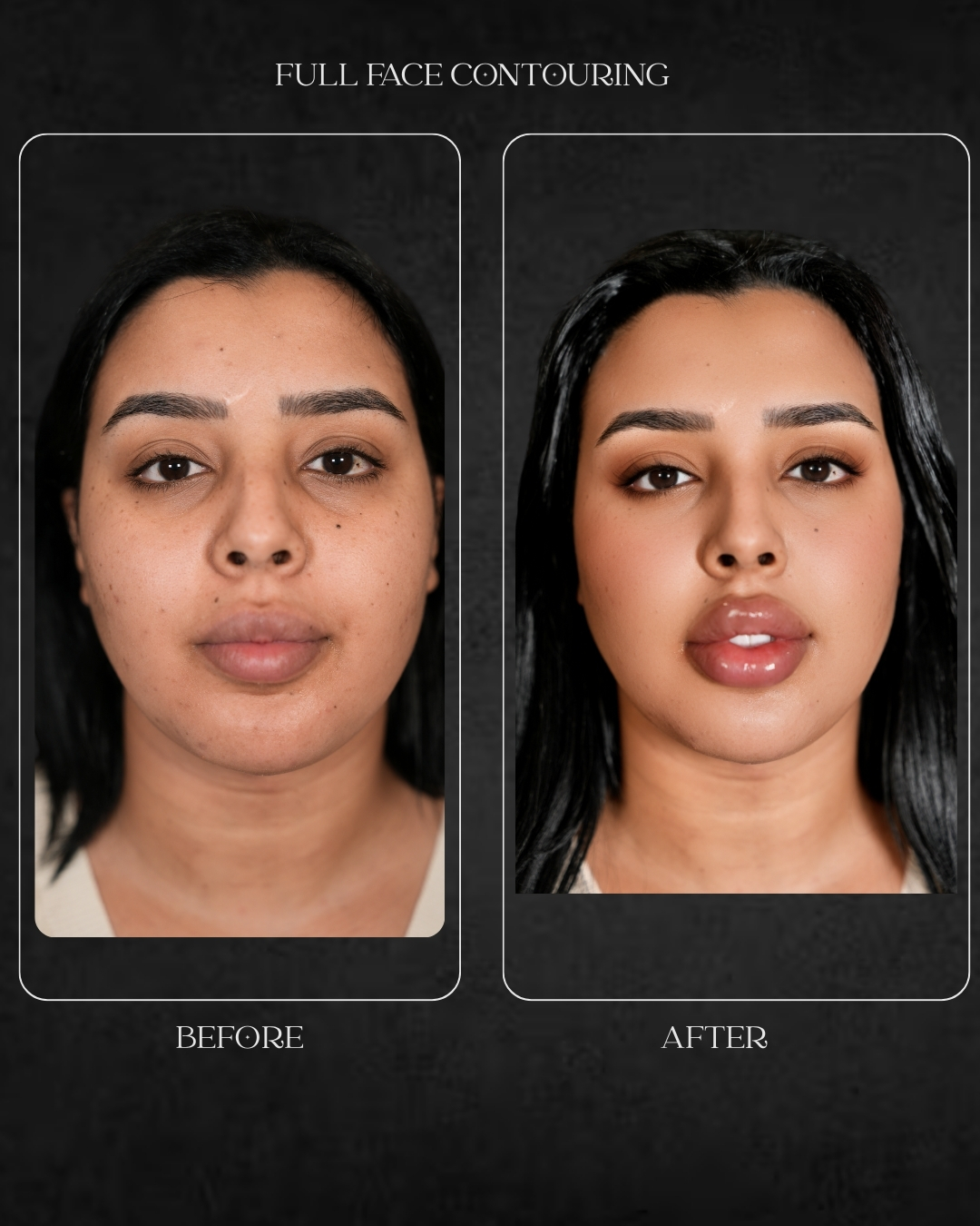 full face contouring