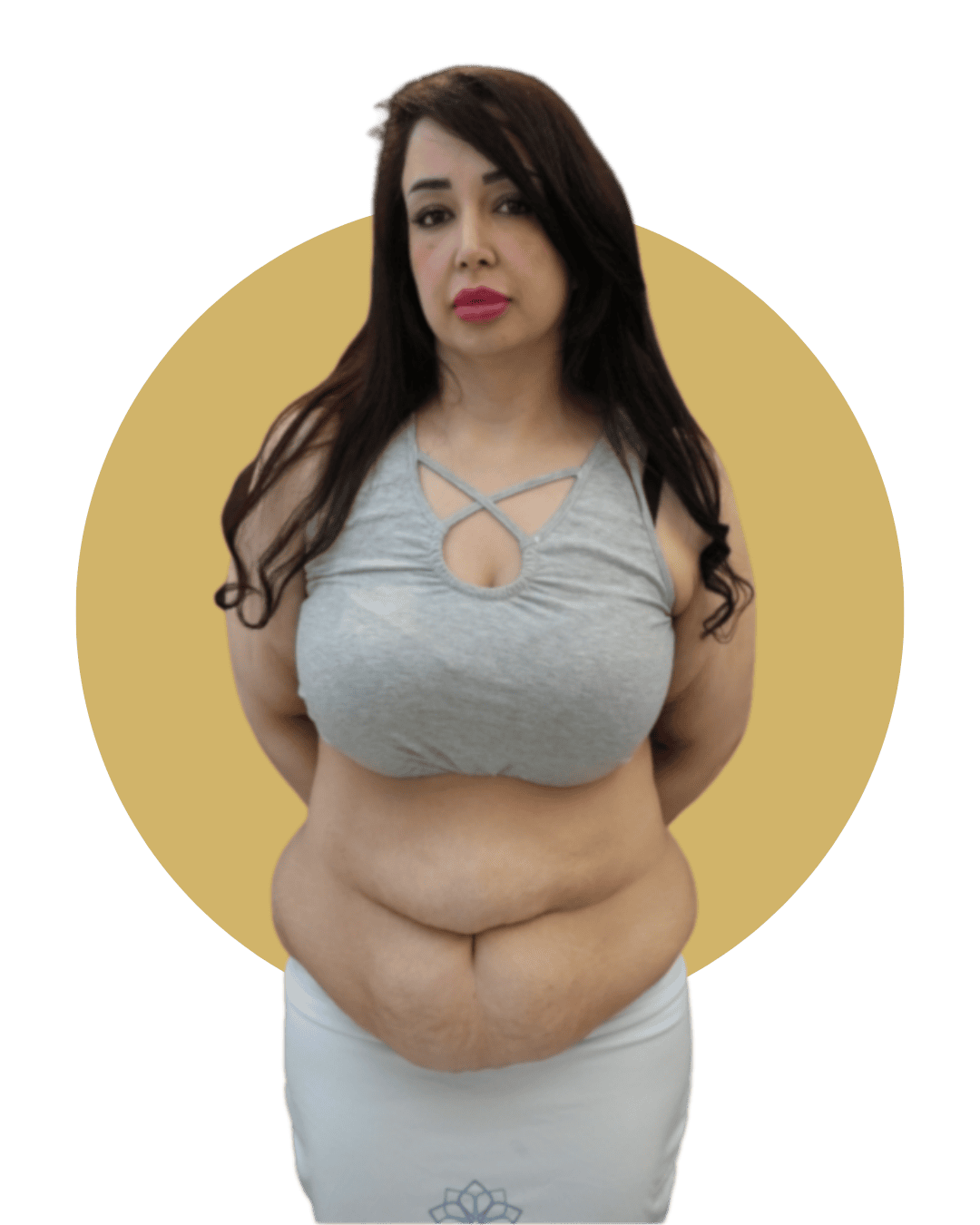 plastic surgery before